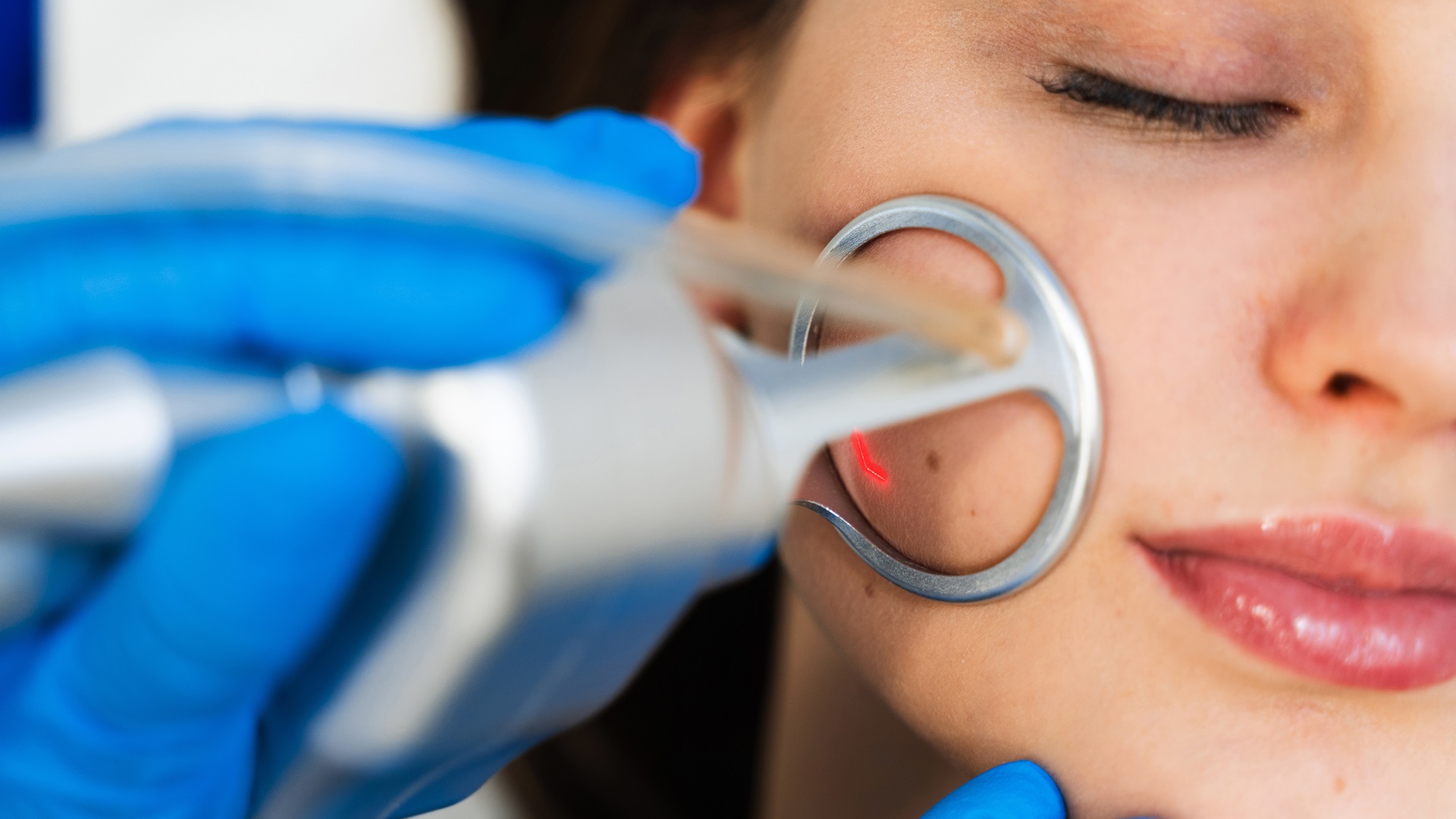 Treatment for facial blemishes